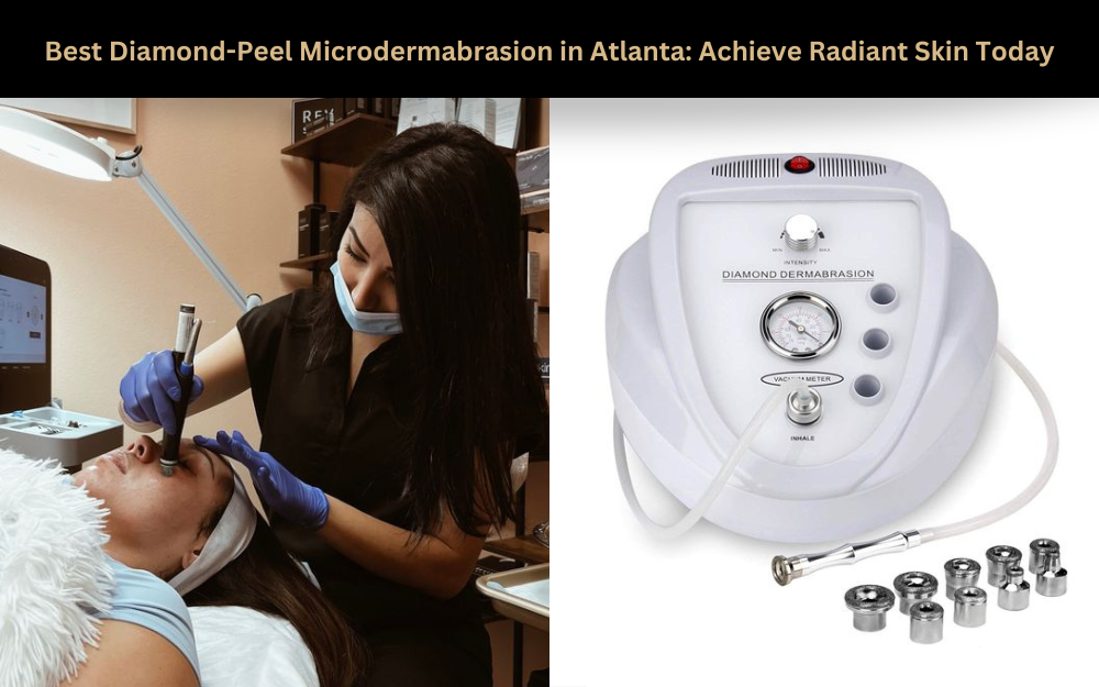 Top Diamond-Peel Microdermabrasion in Atlanta