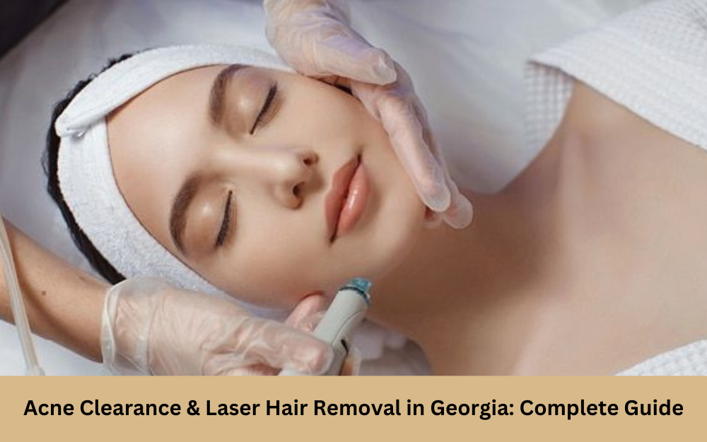 Acne Clearance & Laser Hair Removal in Georgia: Complete Guide