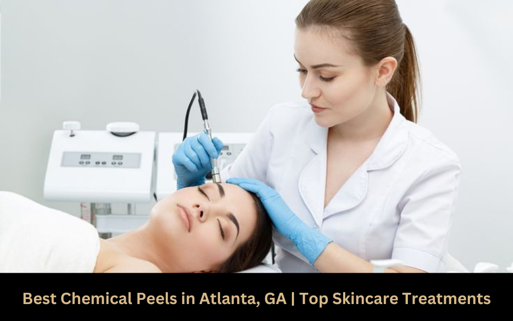 Best Chemical Peels in Atlanta, GA | Top Skincare Treatments