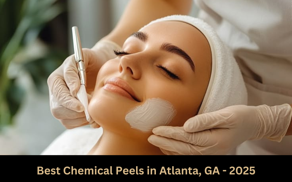 Best Chemical Peels in Atlanta, GA 2025