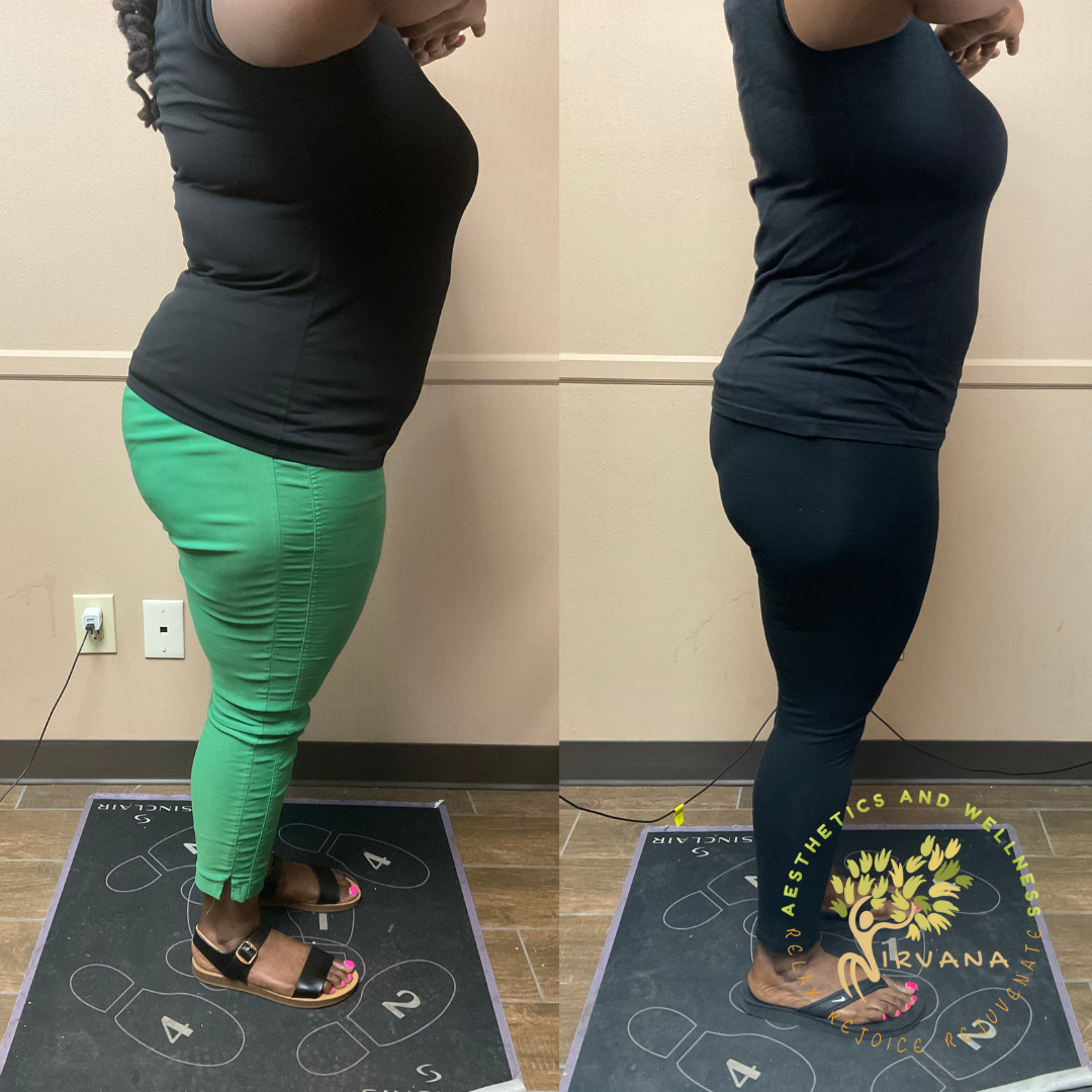 Weight Loss Program